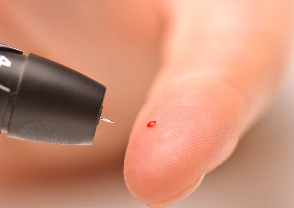 דילול דם טבעי: איך עושים את זה?